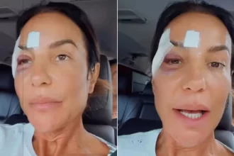 ivete-sangalo-passa-por-cirurgia-neste-domingo,-diz-portal