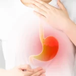 remedios-caseiros-para-acabar-com-o-refluxo-e-aliviar-a-azia