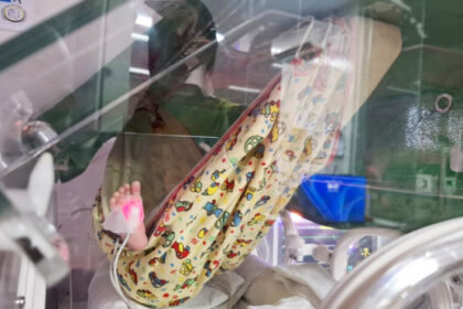 hospital-maternidade-dona-regina-fortalece-cuidado-humanizado-a-recem-nascidos-prematuros-com-redeterapia-–-secom-to