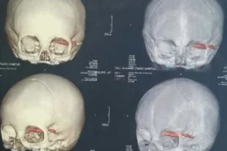 cientistas-acham-cranios-de-2.000-anos,-e-detalhe-nos-dentes-chama-atencao