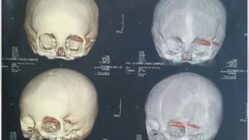 cientistas-acham-cranios-de-2.000-anos,-e-detalhe-nos-dentes-chama-atencao