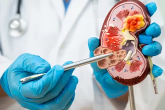 doenca-renal-avanca-no-pais-e-expoe-gargalos-de-acesso-a-diagnostico-precoce-e-a-dialise