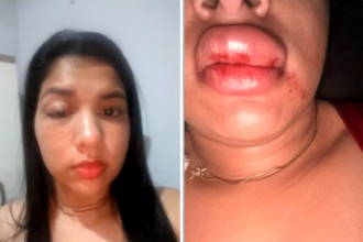‘estou-tendo-que-me-esconder’,-desabafa-jovem-agredida-por-vereador-no-tocantins