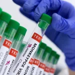 mpox-aumenta-no-brasil-e-reacende-alerta-para-monitoramento-e-vigilancia