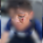 familia-denuncia-agressao-a-aluno-apos-caso-de-bullying-em-escola-no-tocantins