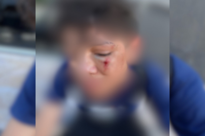 familia-denuncia-agressao-a-aluno-apos-caso-de-bullying-em-escola-no-tocantins