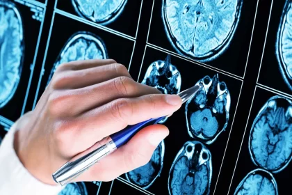 mais-de-50%-dos-diagnosticos-de-autismo-ocorrem-antes-dos-5-anos-de-idade