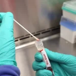 casos-de-mpox-mais-que-dobram-em-20-dias,-com-129-confirmacoes-no-brasil