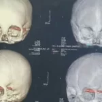 cientistas-acham-cranios-de-2.000-anos,-e-detalhe-nos-dentes-chama-atencao