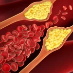 colesterol-alto?-estes-alimentos-baratos-ajudam-a-reduzir-os-niveis