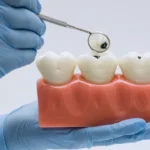 alimentos-“inofensivos”-podem-destruir-o-esmalte-dos-dentes;-veja