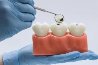 alimentos-“inofensivos”-podem-destruir-o-esmalte-dos-dentes;-veja