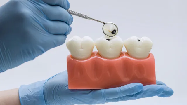 alimentos-“inofensivos”-podem-destruir-o-esmalte-dos-dentes;-veja