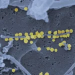 surto-de-hantavirus-nao-tem-potencial-pandemico-e-risco-global-e-baixo,-diz-oms