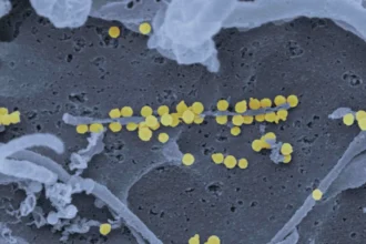 surto-de-hantavirus-nao-tem-potencial-pandemico-e-risco-global-e-baixo,-diz-oms