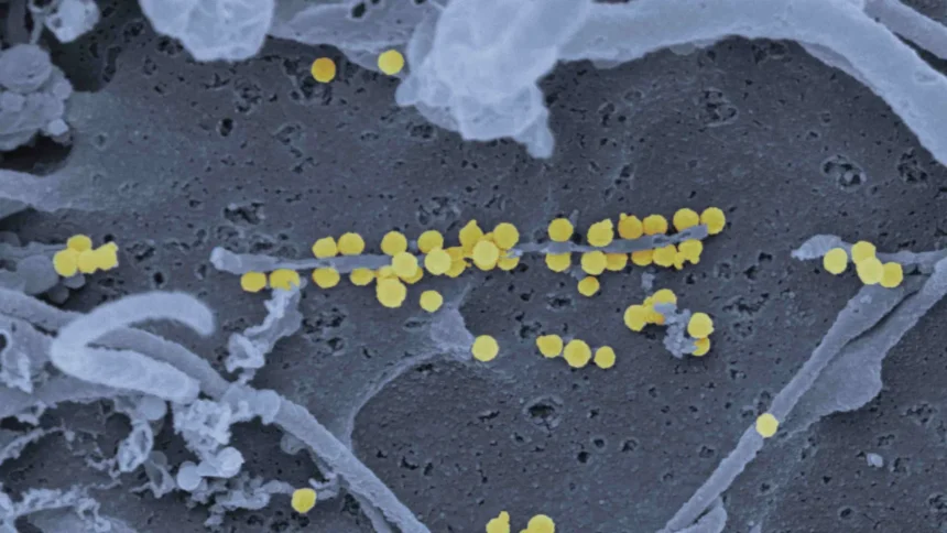 surto-de-hantavirus-nao-tem-potencial-pandemico-e-risco-global-e-baixo,-diz-oms