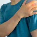 sintoma-discreto-pode-ser-alerta-de-cancer-no-figado;-entenda