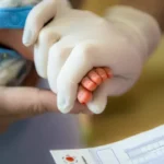gemeos-siameses-ligados-pelo-abdomen-morrem-em-goiania-apos-infeccao