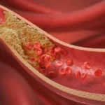 10-alimentos-que-cardiologistas-indicam-para-baixar-o-colesterol
