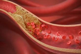 10-alimentos-que-cardiologistas-indicam-para-baixar-o-colesterol