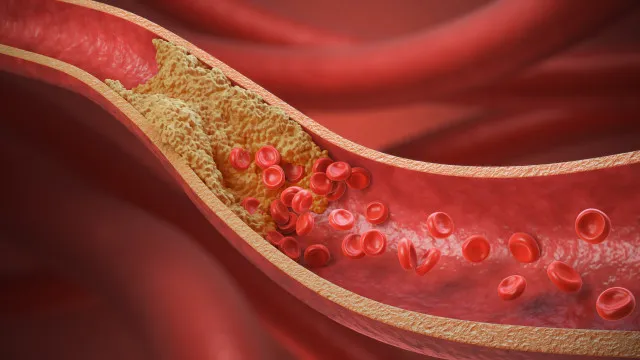10-alimentos-que-cardiologistas-indicam-para-baixar-o-colesterol