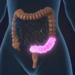 4-regras-obrigatorias-para-proteger-o-intestino-ao-tomar-antibioticos