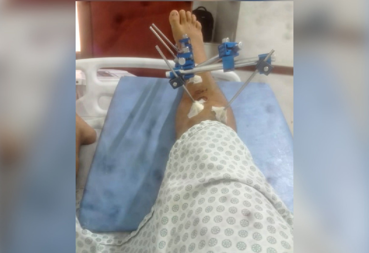 jovem-denuncia-ter-sido-agredido-por-pms-durante-abordagem-e-dentro-de-hospital-no-to