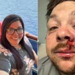 homem-‘mais-azarado-do-alabama’-e-atingido-por-raio-um-ano-apos-ser-ferido-por-fogos-de-artificio-durante-tratamento-com-quimioterapia