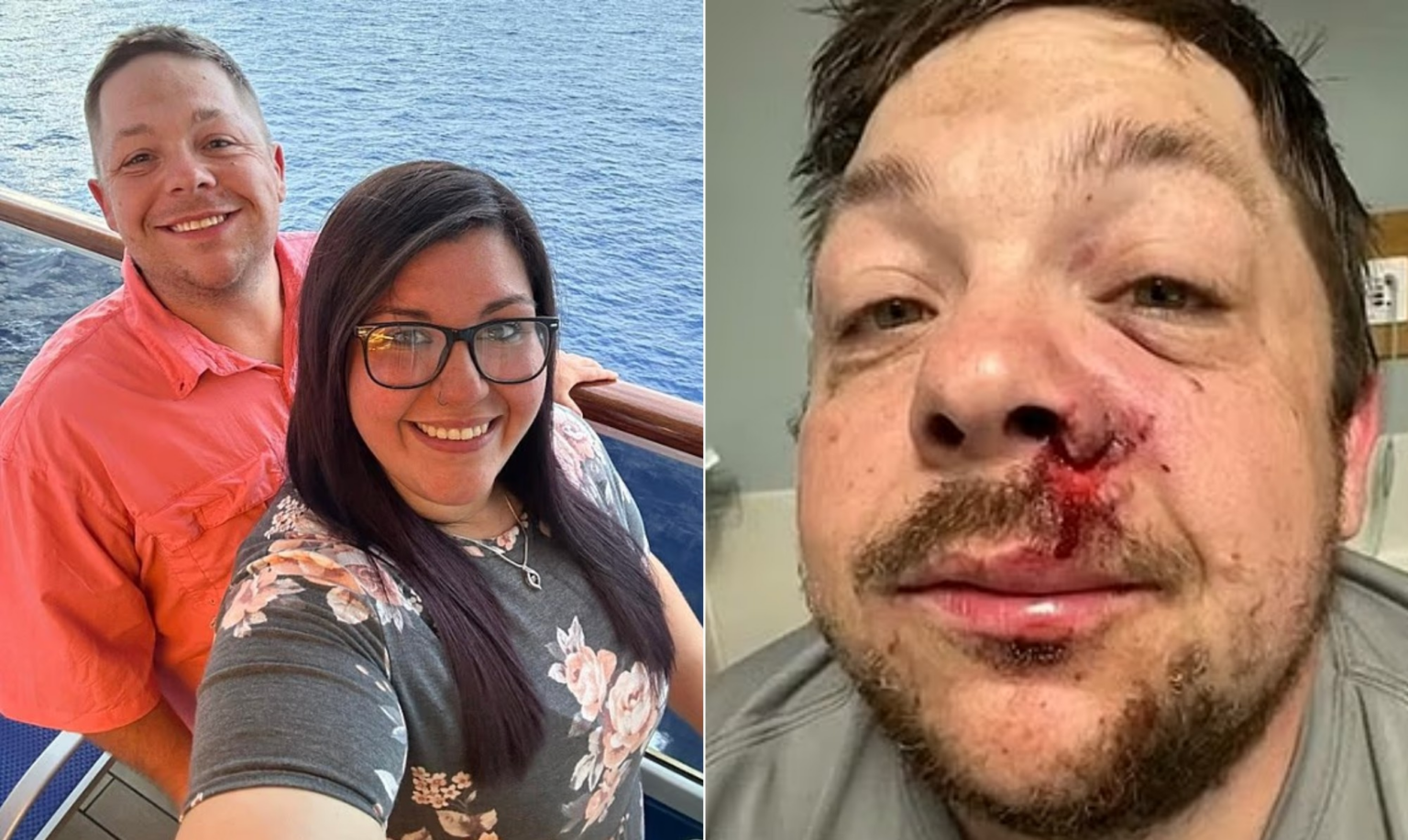 homem-‘mais-azarado-do-alabama’-e-atingido-por-raio-um-ano-apos-ser-ferido-por-fogos-de-artificio-durante-tratamento-com-quimioterapia