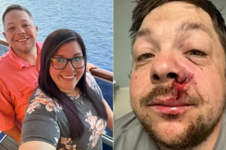 homem-‘mais-azarado-do-alabama’-e-atingido-por-raio-um-ano-apos-ser-ferido-por-fogos-de-artificio-durante-tratamento-com-quimioterapia