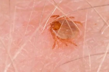 febre-maculosa-mata-17-pessoas-em-sao-paulo-em-2026