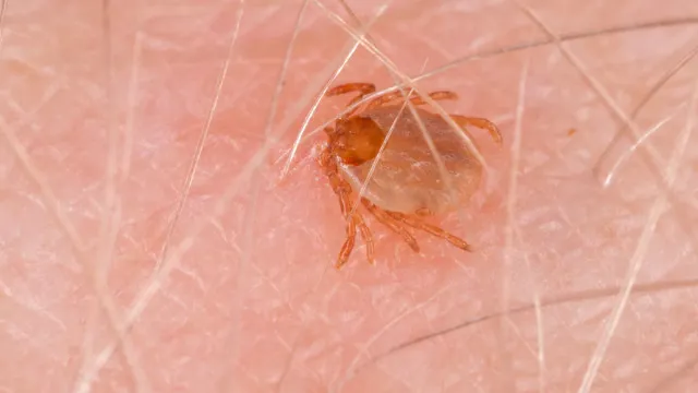 febre-maculosa-mata-17-pessoas-em-sao-paulo-em-2026