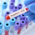 mortalidade-por-hepatite-viral-atinge-1-a-cada-5-pacientes-com-80-anos-no-sus