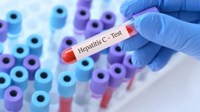 mortalidade-por-hepatite-viral-atinge-1-a-cada-5-pacientes-com-80-anos-no-sus