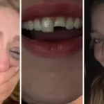 jovem-quebra-dente-na-balada-no-pr,-cola-na-madrugada-e-volta-para-a-festa