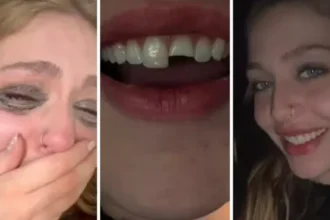 jovem-quebra-dente-na-balada-no-pr,-cola-na-madrugada-e-volta-para-a-festa