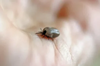 mulher-morre-de-febre-maculosa-no-abc;-carrapatos-foram-encontrados-em-caes-da-vitima
