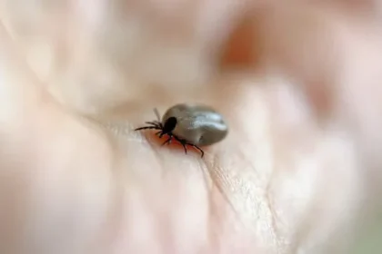 mulher-morre-de-febre-maculosa-no-abc;-carrapatos-foram-encontrados-em-caes-da-vitima