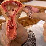aberta-chamada-publica-para-pesquisas-sobre-endometriose