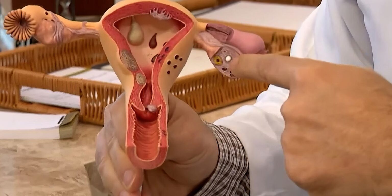 aberta-chamada-publica-para-pesquisas-sobre-endometriose
