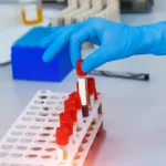 menina-de-6-anos-morre-em-testes-geneticos-na-china:-veja-o-que-se-sabe-ate-agora