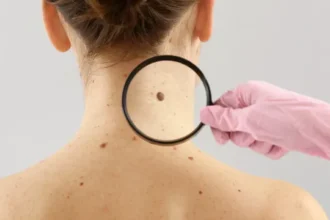 moderna-e-merck-anunciam-sucesso-de-vacina-experimental-com-mrna-contra-recidiva-do-melanoma