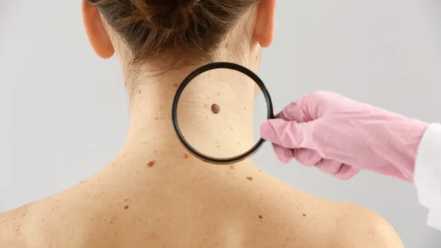 moderna-e-merck-anunciam-sucesso-de-vacina-experimental-com-mrna-contra-recidiva-do-melanoma