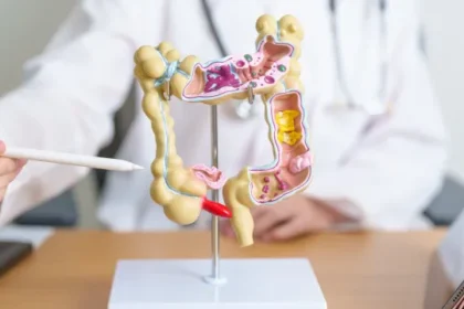 pacientes-com-cancer-colorretal-tem-medicamento-aprovado-pela-anvisa