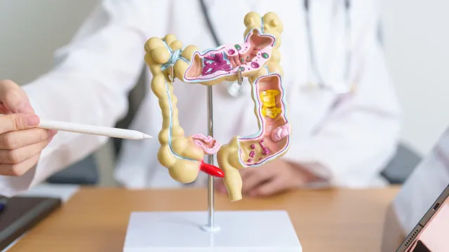 pacientes-com-cancer-colorretal-tem-medicamento-aprovado-pela-anvisa