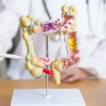pacientes-com-cancer-colorretal-tem-medicamento-aprovado-pela-anvisa