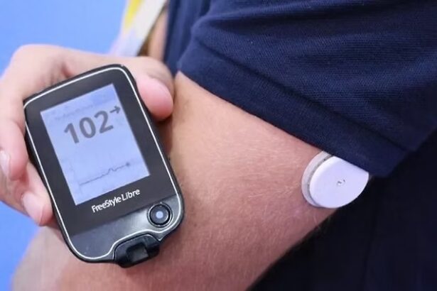 saude-de-palmas-vai-distribuir-sensores-de-glicose-para-criancas-e-adolescentes-com-diabetes-tipo-1