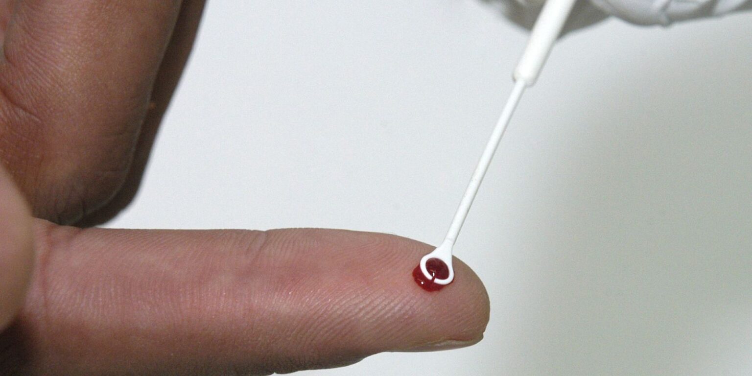 fiji-declara-emergencia-nacional-por-hiv-com-1-caso-a-cada-60-pessoas