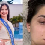 empresario-e-condenado-por-agredir-ex-miss-universo-apos-crise-de-ciumes