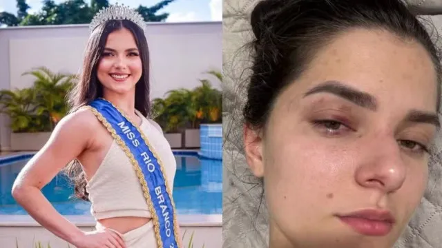 empresario-e-condenado-por-agredir-ex-miss-universo-apos-crise-de-ciumes